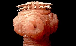 Taenia solium